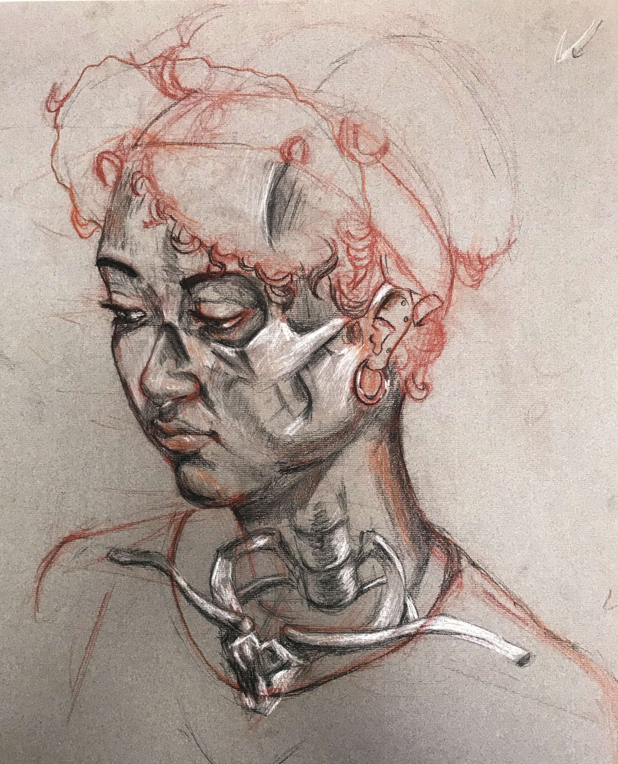 Underlying Anatomy
